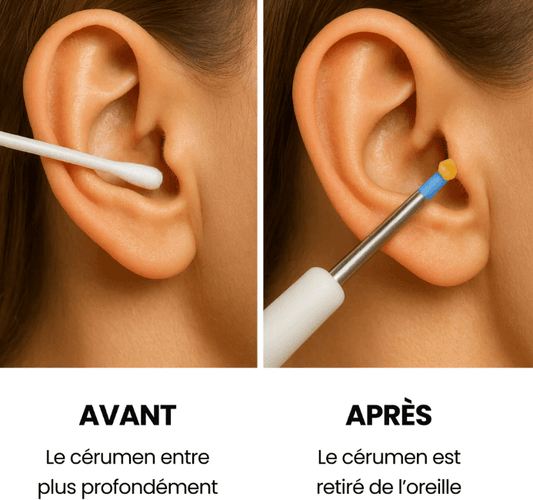 NETTOYEUR D'OREILLE INTELLIGENT HD - PROTEGEZ VOTRE AUDITION